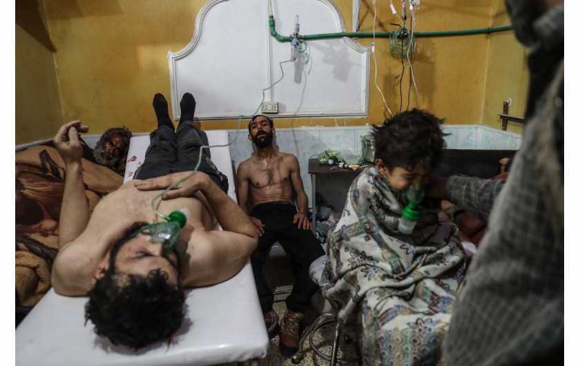 fot. Mohammed Badra, EPA, Nominacja do nagrody World Press Photo of the Year

Mieszkańcy wschodniej Ghouty, podmiejskiej dzielnicy Damaszku i jednego z ostatnich bastionów syryjskich rebeliantów od 5 lat są pod oblężeniem sił rządowych. Podczas ostatniej ofensywy Ghouta stała się celem bombardowań i przynajmniej jednego ataku z użyciem gazu. Szacuje się, że między 18 lutego, a 3 marca 2018 roku zginęło 1005 osób, a 4829 zostało rannych. Zniszczono też 13 szpitali i klinik. Na zdjęciu cywile otrzymujący wparcie po domniemanym ataku z uzyciem gazu bojowego. 25.02.2018